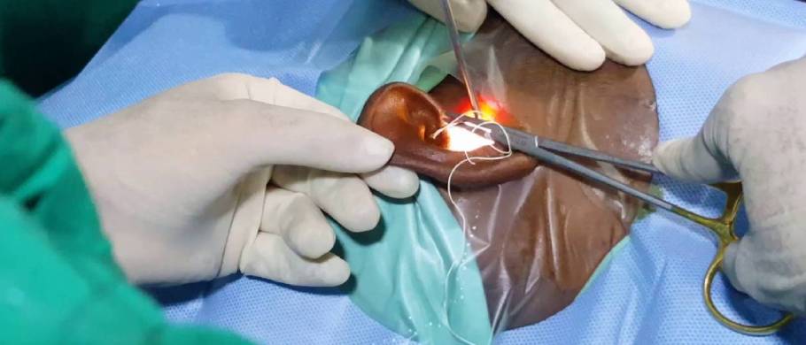 endoscopic ear surgeries 1