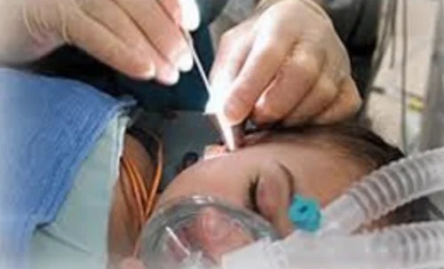 micro ear surgery